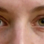 Efectos antiaging de los hongos en la salud de la piel